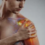 Shoulder Pain