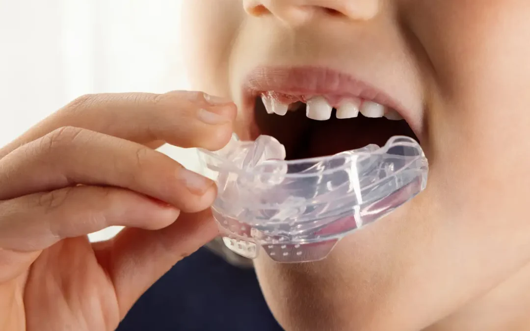 What Are Myobraces & How Do They Work?